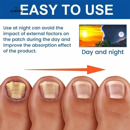 Fungal Nail Patches - 40 Days Nail Recovering Kit ( Pack of 2 - 42 Patches )