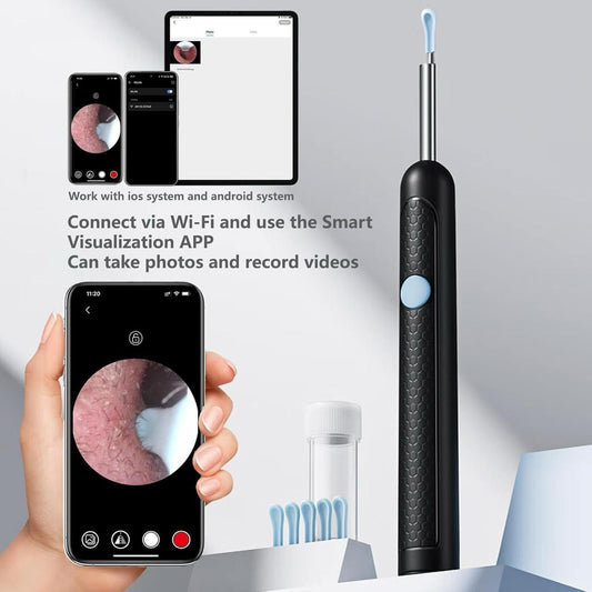 Earwax Cleaning with Camera